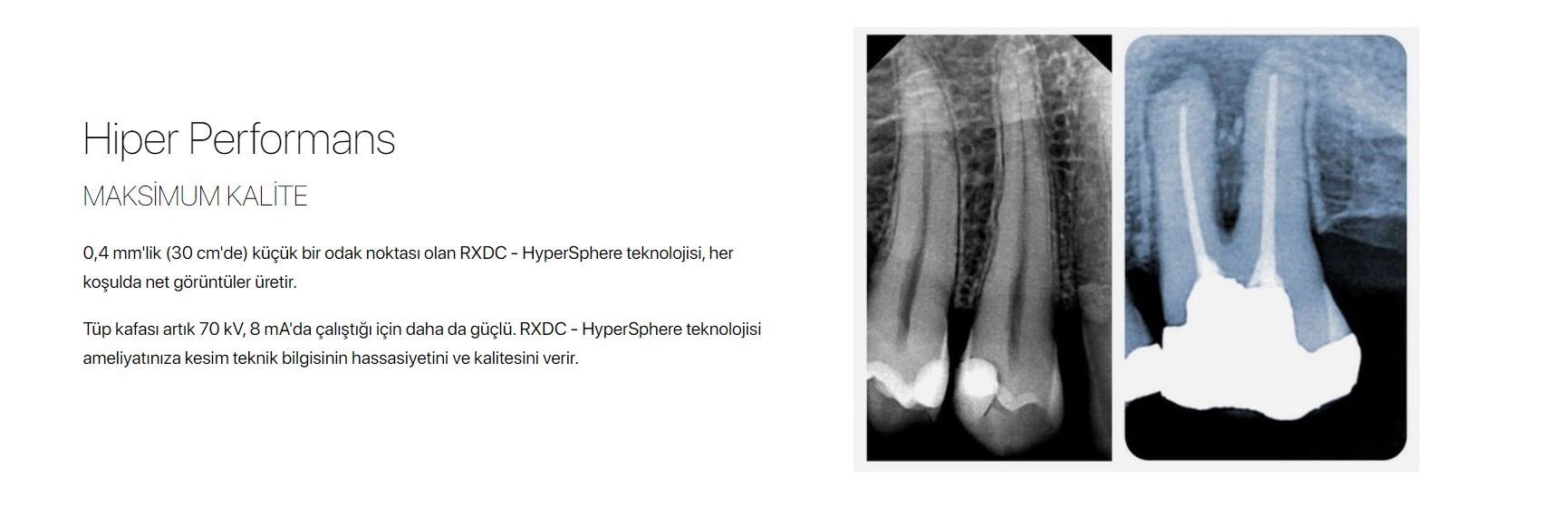 dental röntgen