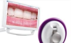 C-U2 HD USB AĞIZ İÇİ KAMERA