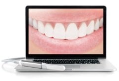 C-U2 HD USB AĞIZ İÇİ KAMERA
