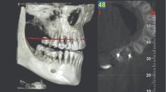 Myray ProXIma X6, Dental Xray Sistemleri