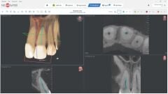 Myray ProXIma X6, Dental Xray Sistemleri