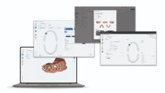MYRAY MyScan WL Ağız İçi Tarayıcı